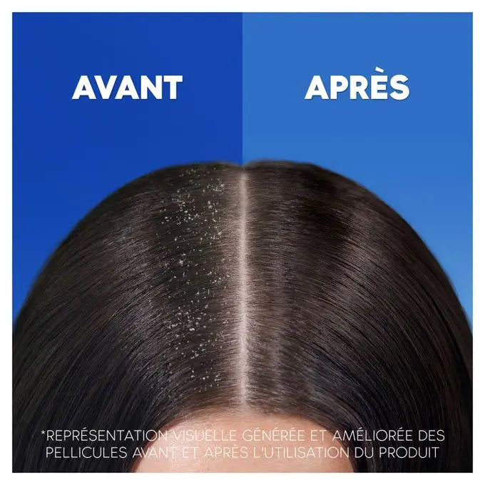 Head & Shoulders<br> <b> Shampooing Antipélliculaire</b><br> Citrus Fresh<br><h5>Tout type de cheveux-285ml</h5>Origine France <img style="vertical-align: middle;" src="https://bit.ly/3VT5bp1">