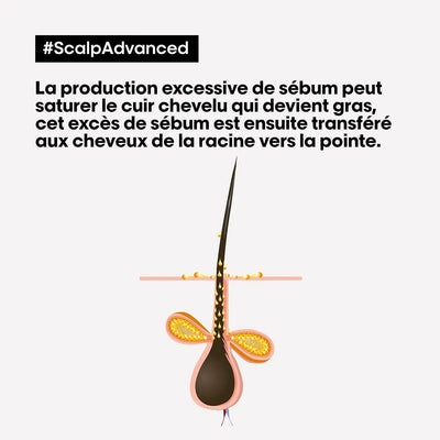 L'Oréal Professionnel<br><b>série expert Scalp Advanced AHA 3%</b><br><h5>Shampoing Dermo-Purifiant Cheveux Gras - 300 ml</h5>Origine France </h6> <img style="vertical-align: middle;" src=" https://shorturl.at/bDMR9">