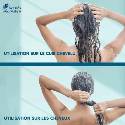 Head & Shoulders Derma X Pro apaise Shampoing Antipélliculaire Cuir chevelu sec - lot de 2 flacons de 250 & 200ml Seven-dz